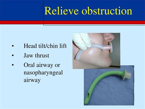 Ppt Airway Management In Trauma Trauma Conference Uw Hospital And