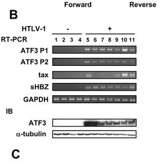 Constitutive Expression Of ATF3 In ATL Cells A Schematic Diagram Of