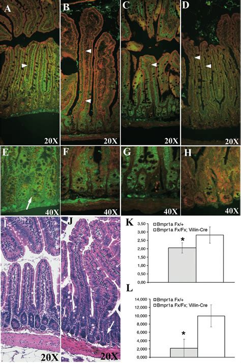 Loss Of Bmp Signaling Cascade And Histologic Analysis Of The Intestinal