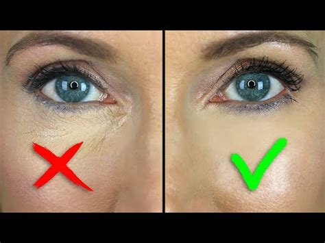 How To Get Rid Of Lines Under Eyes Without Makeup Mugeek Vidalondon