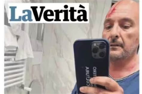 Caso Boccia Spunta Foto Di Sangiuliano In Hotel Con La Ferita Alla