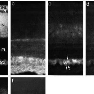 Molecular Markers For RGCs And Cells Of The GCL Sections Of E18 Retina