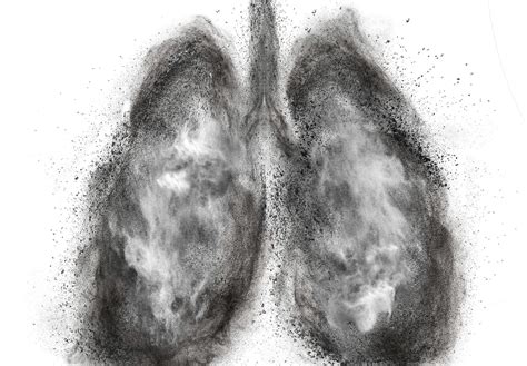 Black Lung Disease: Still All Too Present | Radio Health Journal