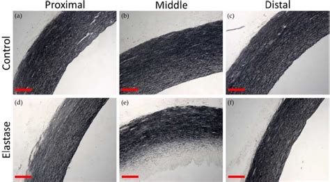 Representative Histology Of Local Elastin Degradation In A Whole