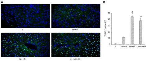 Mild Hypothermia Pretreatment Promotes Antiapoptotic Function And