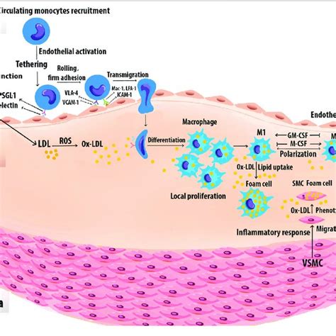 Foam Cell Formation Monocytes Are Recruited To The Vascular Arginase