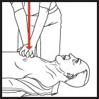 CPR illustrated in three simple steps