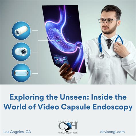 Inside The World Of Video Capsule Endoscopy Gastroenterologist Los