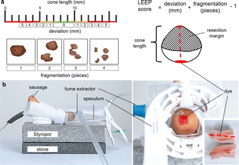 Simulator Design And Calculation Of Leep Score The Upper Part Of The