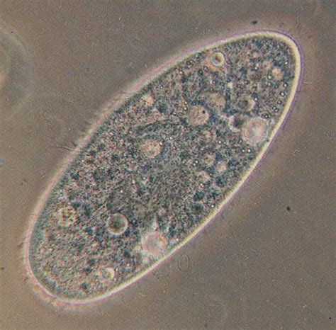 Paramecium - Classification, Structure, Function and Characteristics