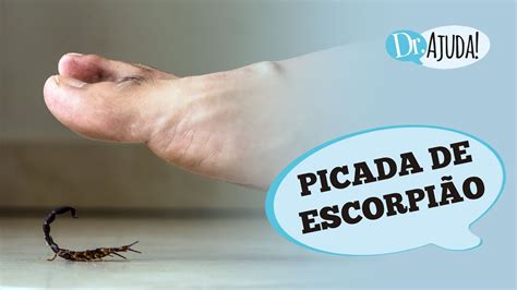 Picada De Escorpi O O Que Acontece Sintomas O Que Fazer E Como Prevenir