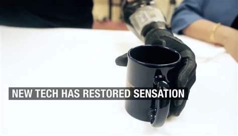 Fiu S Neural Enabled Prosthetic Hand System Restoring Sensation To