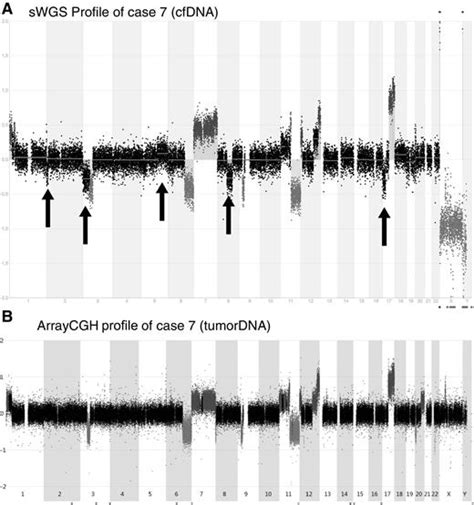 Shallow Whole Genome Sequencing On Circulating Cell Free Dna Allows