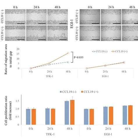 Effect Of CCL19 CCR7 On Migration And Cell Proliferation A A Wound