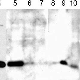 Immunoblot Demonstration Of The Sds Polyacrylamide Gel Electrophoresis