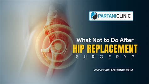 What NOT To Do After Hip Replacement Surgery Partani Clinic