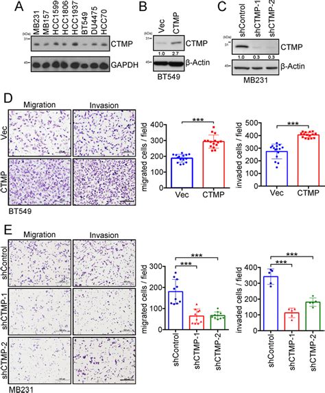 High CTMP Levels Promote Migration And Invasion In TNBC Cells A The