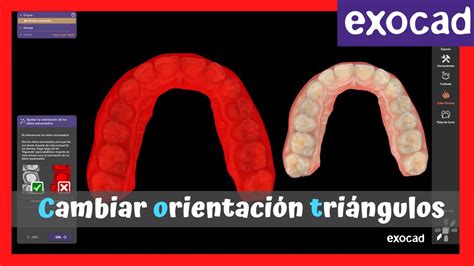 Exocad Solucionar Problema Con Orientaci N Tri Ngulos Youtube