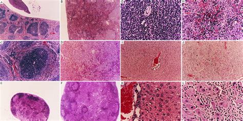 Ectopic Expression Of A Myb In Transgenic Mice Causes Follicular