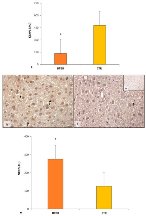 Ijms Free Full Text Hepatic Alterations In A Btbr T Itpr Tf J