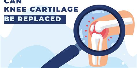 Can Knee Cartilage be Replaced? Know The Answer On Knee Cartilage Damage Treatment