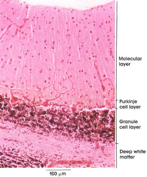 Purkinje Cell Histology