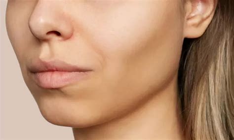 High Cheekbones Vs Low Cheekbones Causes And Treatments