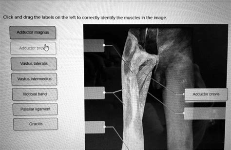 Solved Click And Drag The Labels On The Left To Correctly Identify The
