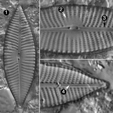 Navicula elsoniana | Species - Diatoms of North America