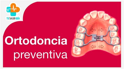 Ortodoncia Preventiva Tu Salud Guía YouTube