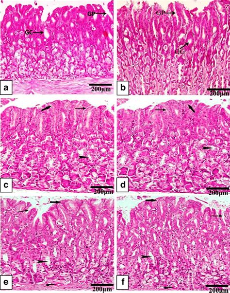 Photomicrographs Of H E Stained Sections In The Stomach Of A B