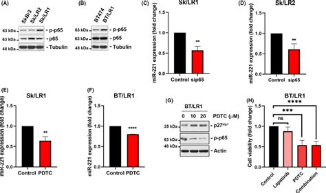 Nf‐κb Pathway Involved In Mir‐221 Upregulation In Lapatinib‐resistant