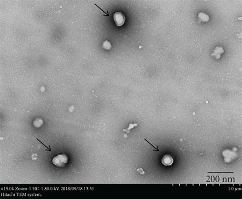 Identification Of Adscs Derived Exosomes From The Conditioned Medium