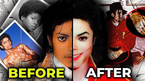 The Real Reason Why Michael Jackson S Skin Turned White Mj Forever