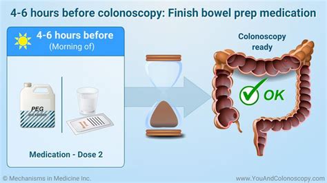 What Is A Colonoscopy And How Do I Prepare For It Colonoscopy Prep Medication Colon Cleanse