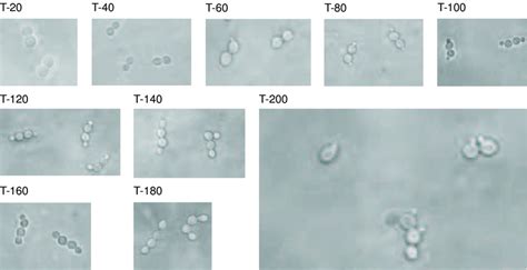 Phase Contrast Microscopy Images Selected Images Showing Examples Of Download Scientific