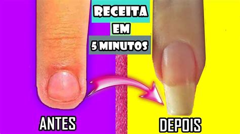 UNHAS GRANDES EM 3 DIAS RECEITA CASEIRA FEITA EM APENAS 5 MINUTOS