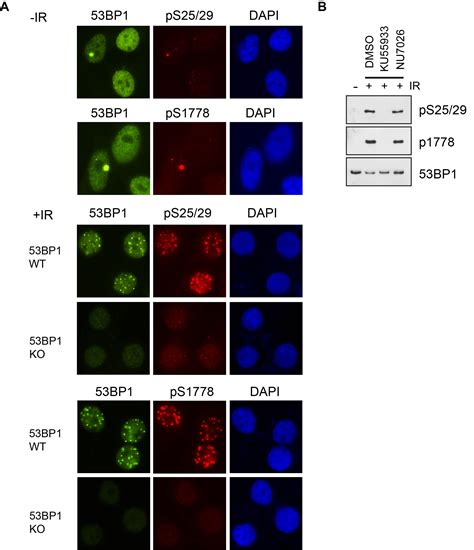 Cell Cycle Dependent Inhibition Of 53bp1 Signaling By Brca1 Abstract