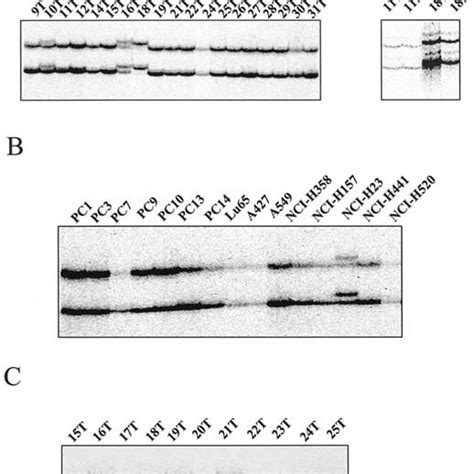 A Pcr Sscp Analysis Of Exon 2 Of The Ing1b Gene Showed Mobility