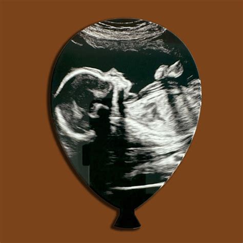 Кольорова акрилова табличка з першим фото дитинки - УЗД Ultrasound ...