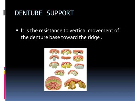 Ppt Dsp 332 Principles Of Complete Denture Prosthodontics Powerpoint