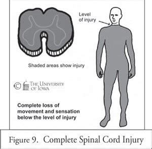 Spinal Cord Injuries Flashcards Quizlet