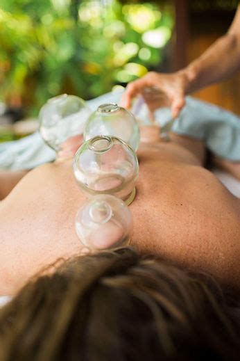 Acupuncture For Arthritis In North Shore Back Pain Cupping Therapy