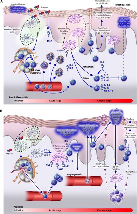 Contrasting Pathogenesis Of Atopic Dermatitis And Psoriasis—part Ii