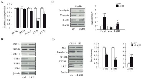 LKB1 Downregulates ZEB1 Expression In Hep3B Cells A RT QPCR And B