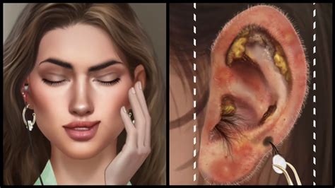 Asmr Deep Ear Cleaning Animation Ear Wax And Worms Removal Youtube