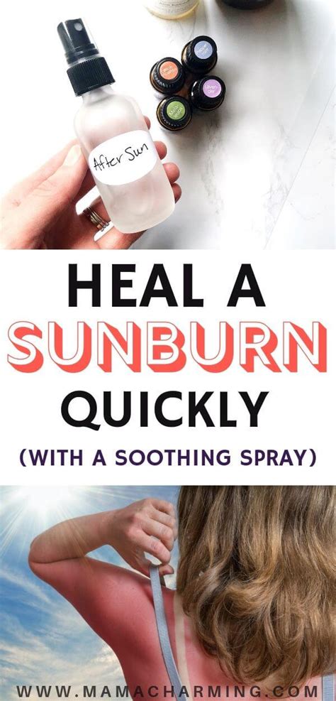 Natural Sunburn Relief Artofit