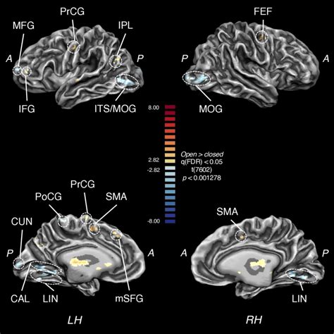 TMS Evoked FMRI Activations Depending On Neurocognitive State