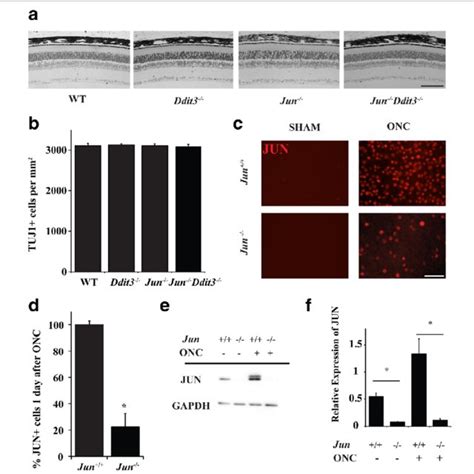 Jun And Ddit3 Deficiency Does Not Alter Retinal Morphology A Semi Thin