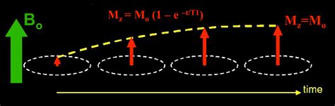 T Relaxation Questions And Answers In Mri